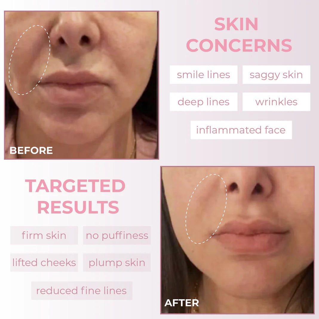 Omni™ Sculptor Pro