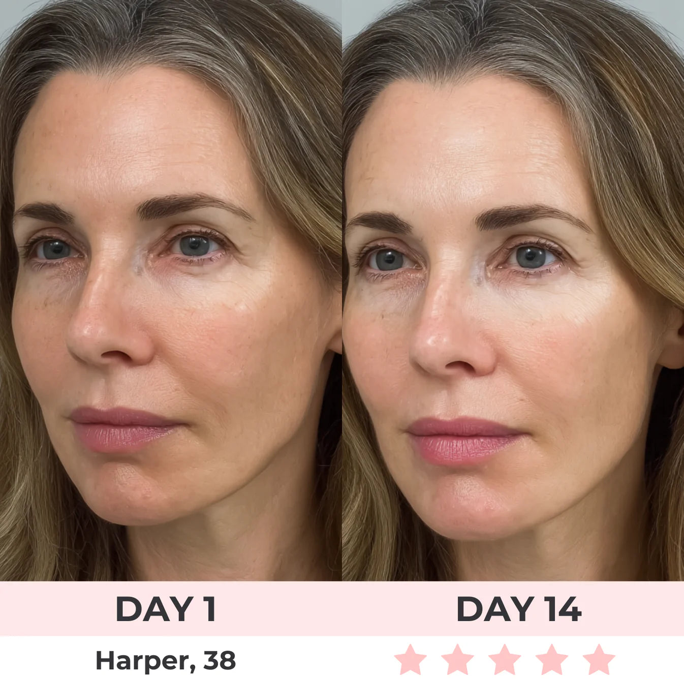 Omniskin™ Red Light Under-Eye Repair