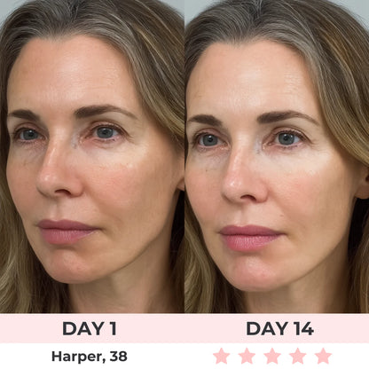 Omniskin™ Red Light Under-Eye Repair