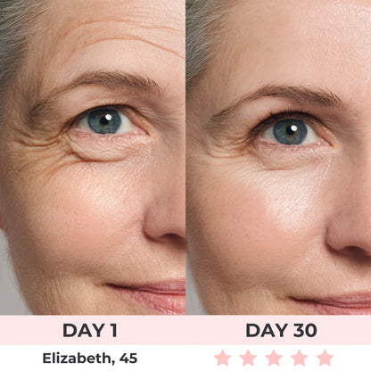 Omniskin™ Red Light Under-Eye Repair