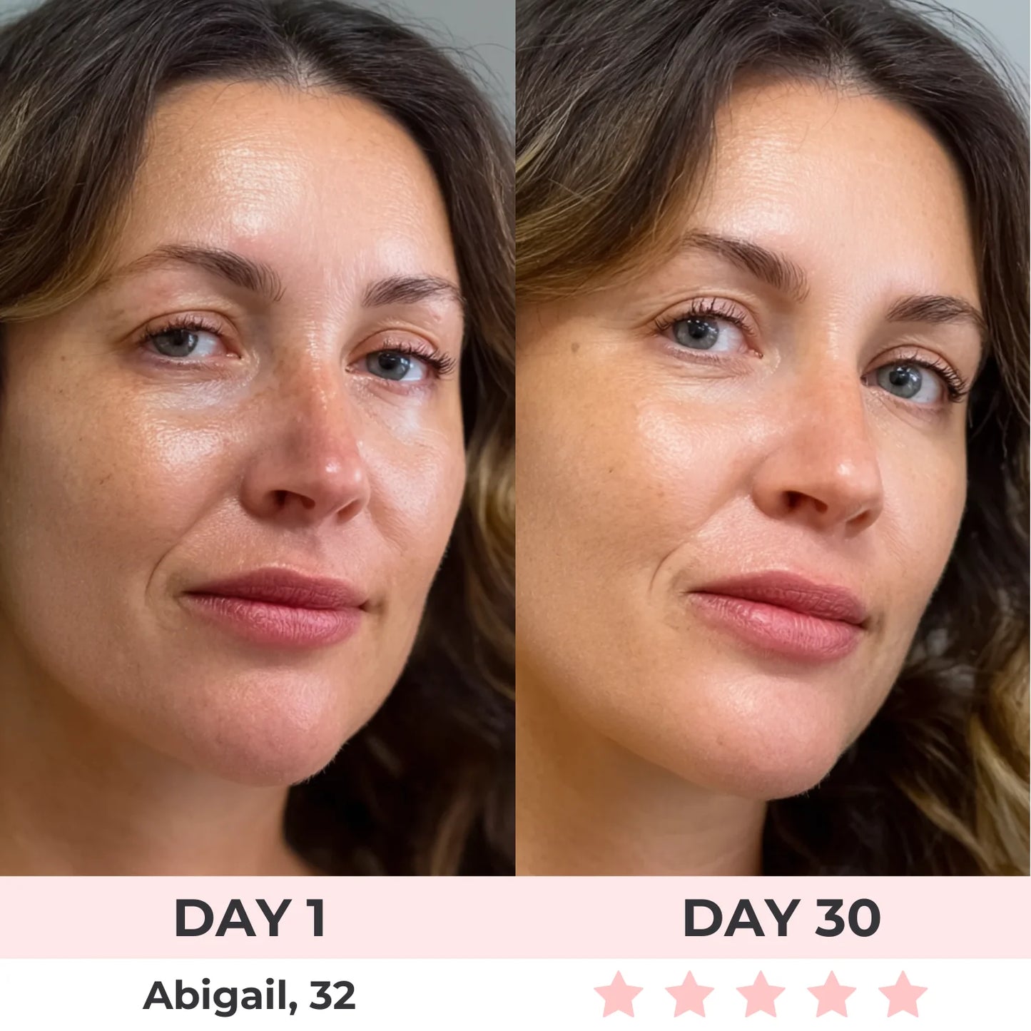 Omniskin™ Red Light Under-Eye Repair