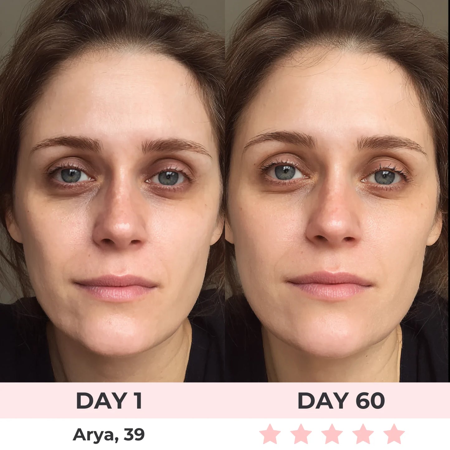 Omniskin™ Red Light Under-Eye Repair