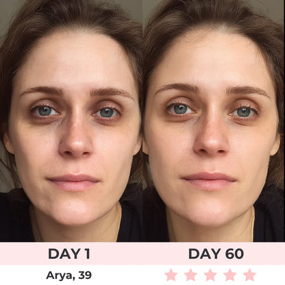 Omniskin™ Red Light Under-Eye Repair