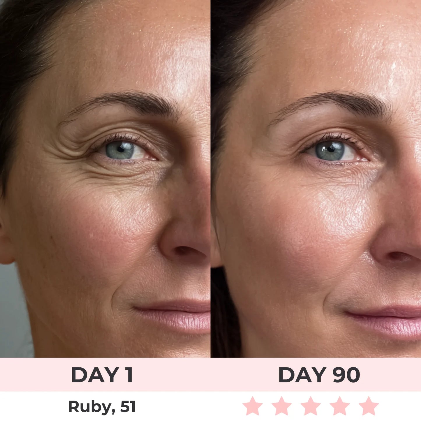 Omniskin™ Red Light Under-Eye Repair