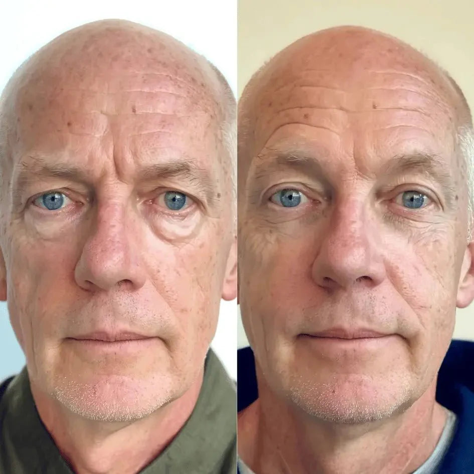 Omniskin® 2-in-1 Red Light Therapy + EMS Under-Eye Repair for Men