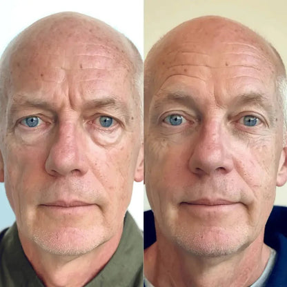 Omniskin® 2-in-1 Red Light Therapy + EMS Under-Eye Repair for Men