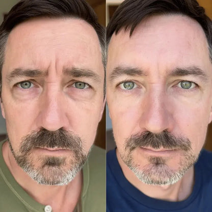 Omniskin® 2-in-1 Red Light Therapy + EMS Under-Eye Repair for Men