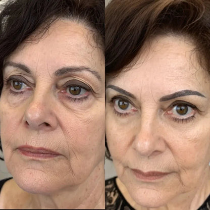 Omniskin™ LED Under-Eye Repair