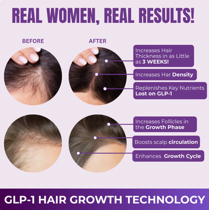 Hair Growth Accelerator Soft Chews