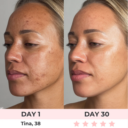 Contour Face LED Therapy Mask